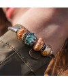 Golden Willow Bead